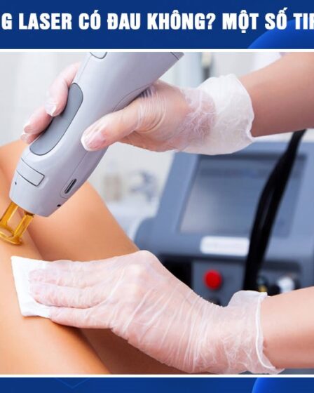 Triệt lông bằng công nghệ Diode laser ruby AI có đau không?